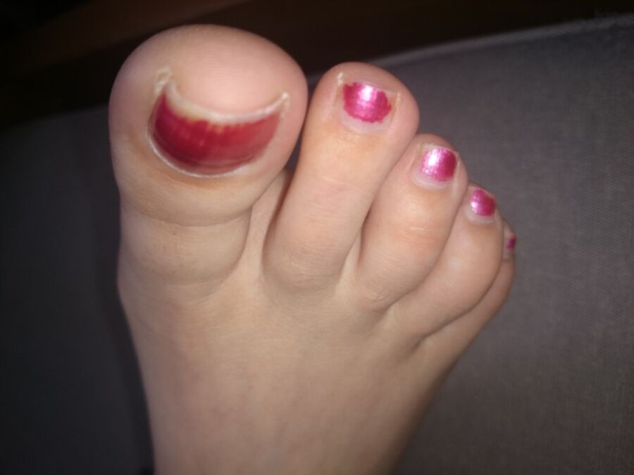 Free porn pics of Girlfriends Sleeping Feet ( toenails need painting lol) 1 of 19 pics