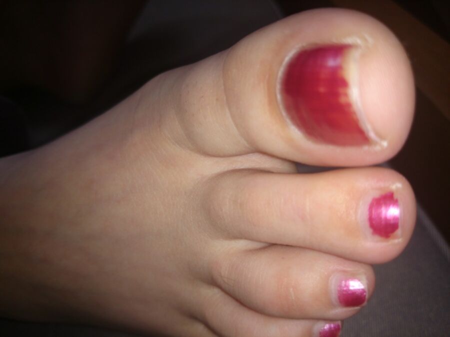 Free porn pics of Girlfriends Sleeping Feet ( toenails need painting lol) 15 of 19 pics