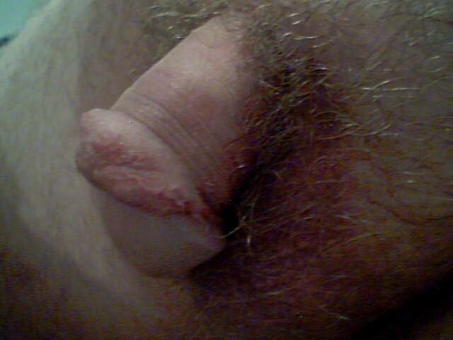 my small baby cock, feel free to humiliate me 7 of 10 pics