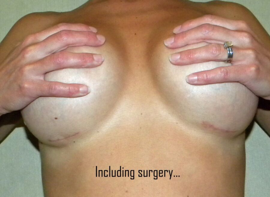 Free porn pics of Why is plastic surgery booming in  Britain? 1 of 35 pics