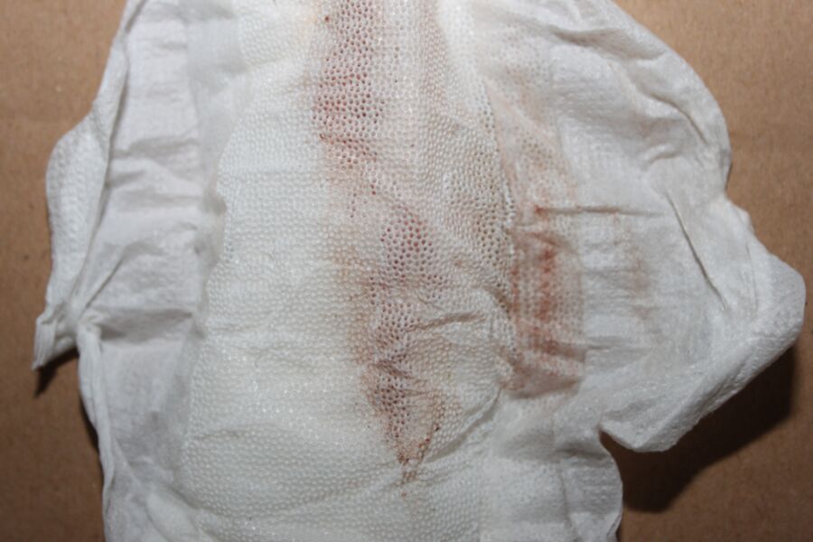Free porn pics of  dirty pad with very blood of my mother in law 5 of 15 pics