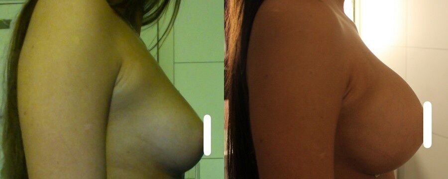 Free porn pics of Hot norwegian teen! great tits! 24 of 66 pics